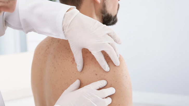Top Dermatologist Appointment in Dunkirk MD